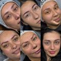 Gamze Çelik Beauty Center resim 5