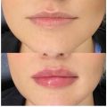 Seda Keskin Beauty resim 5