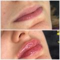 Alp's Care Beauty Center | Güzellik Merkezi | Anamur Kuaför resim 3