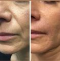 ZASYA Beauty resim 3